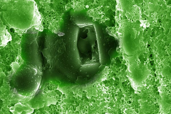 Green and black microscopic view of stomata in a Douglas fir needle